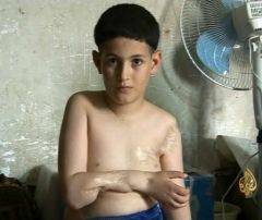 Al Jazeera - The child Abdullah Report